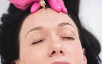 Radiesse: The Dermal Filler for Your Smooth Skin and Wrinkles