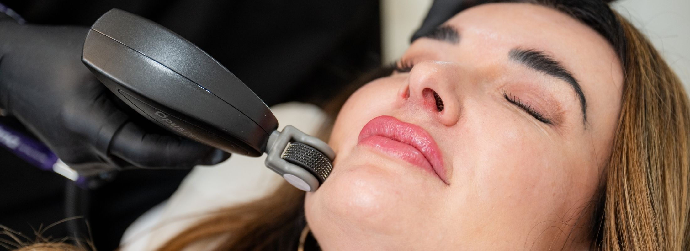 bnr-pic-image-opus-plasma-refresh Botox Injection, Refresh Aesthetics