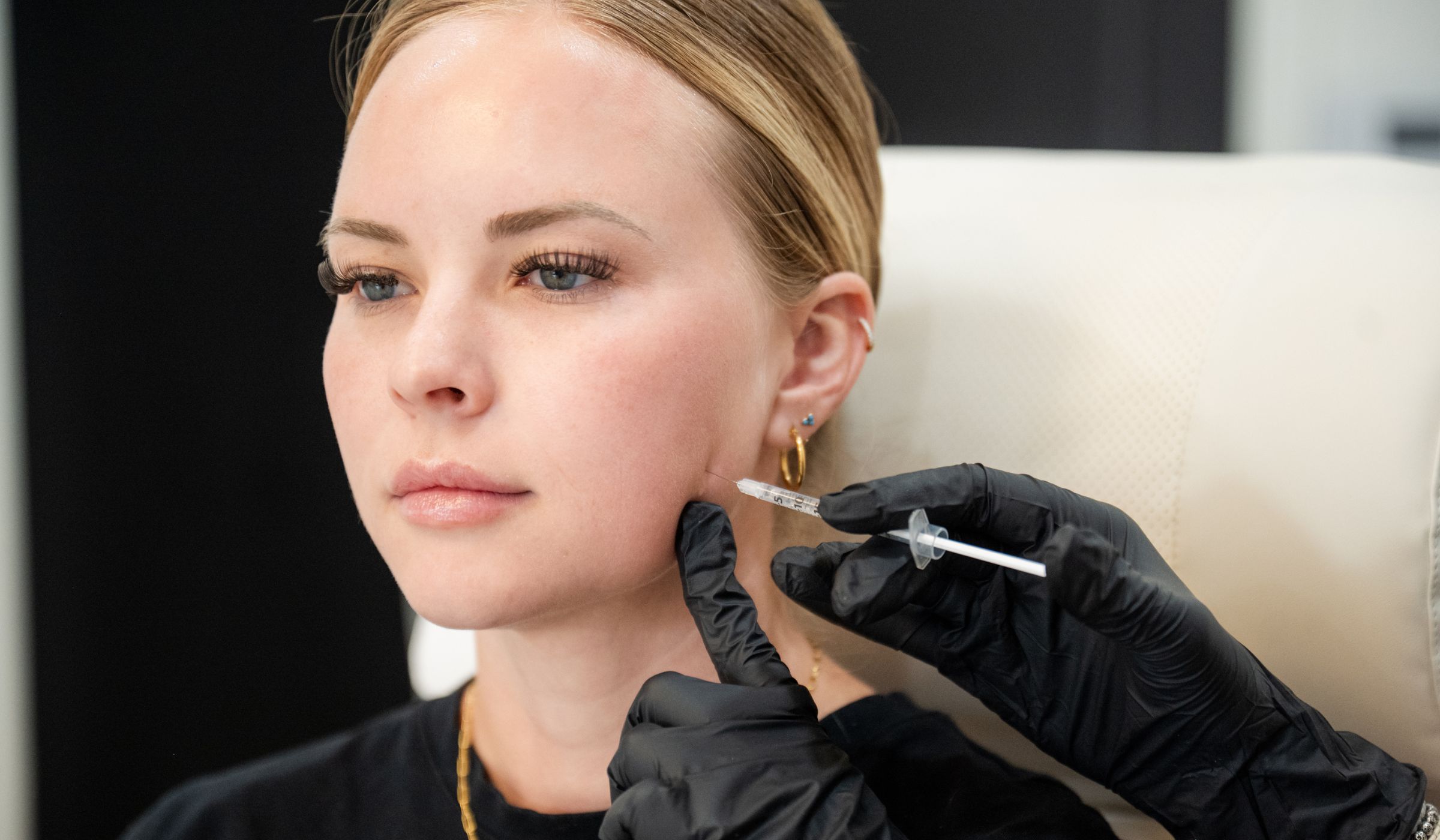 bnr-image-filler-rha2 Botox Injection, Refresh Aesthetics