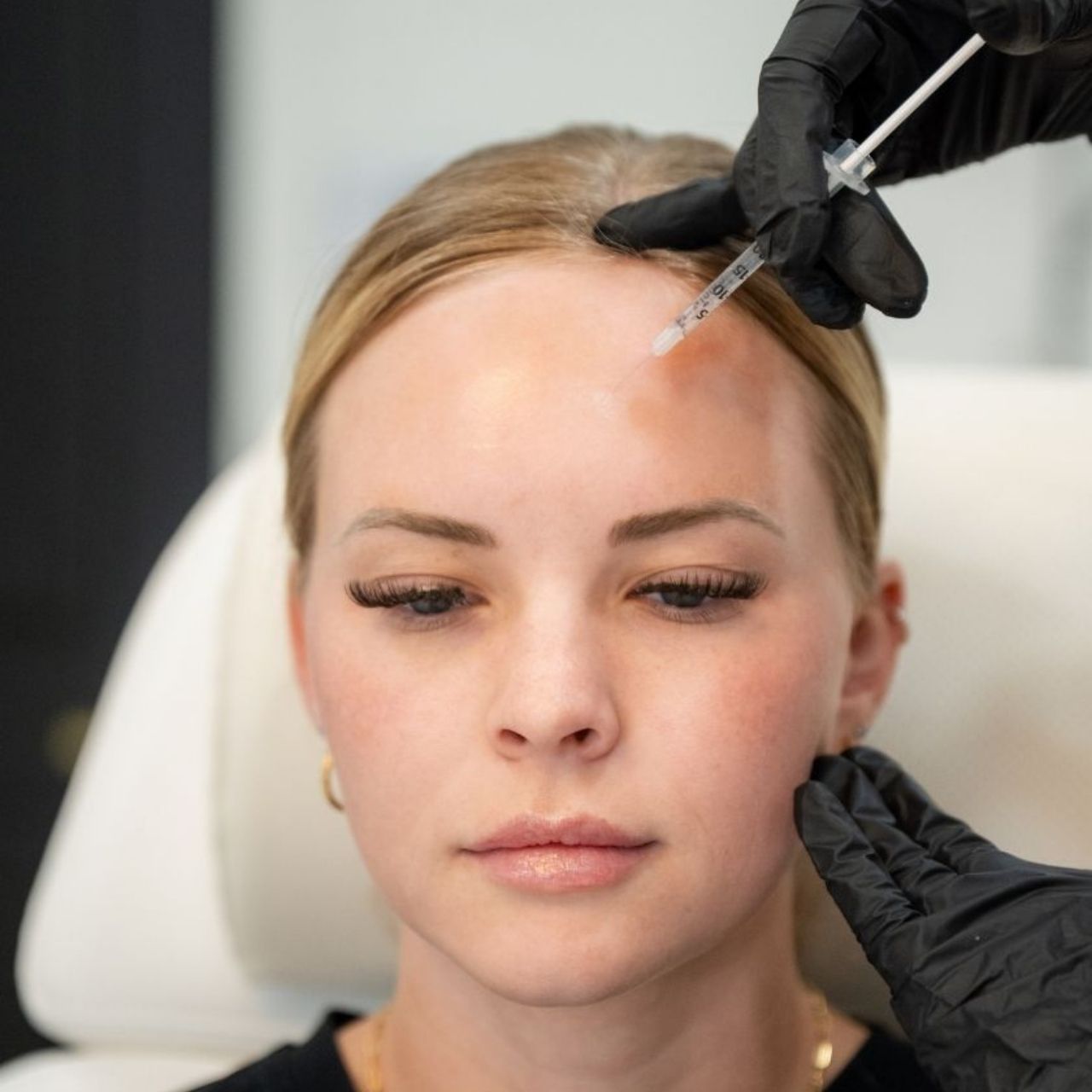 pic-image-injections-botox Botox Treatment - Refresh Aesthetics
