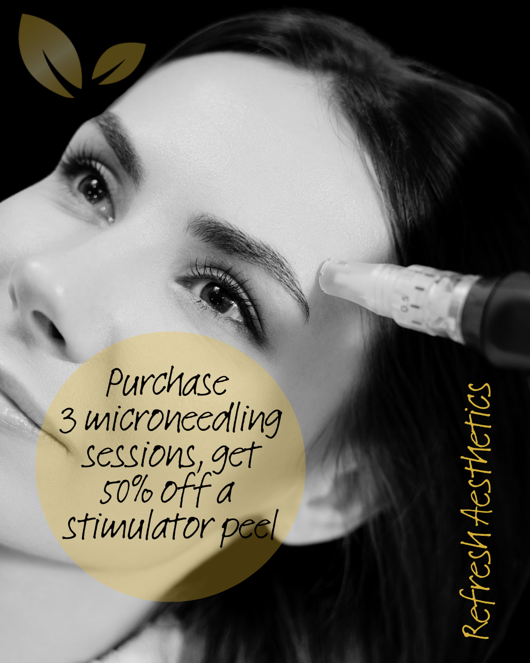 Botox Treatment